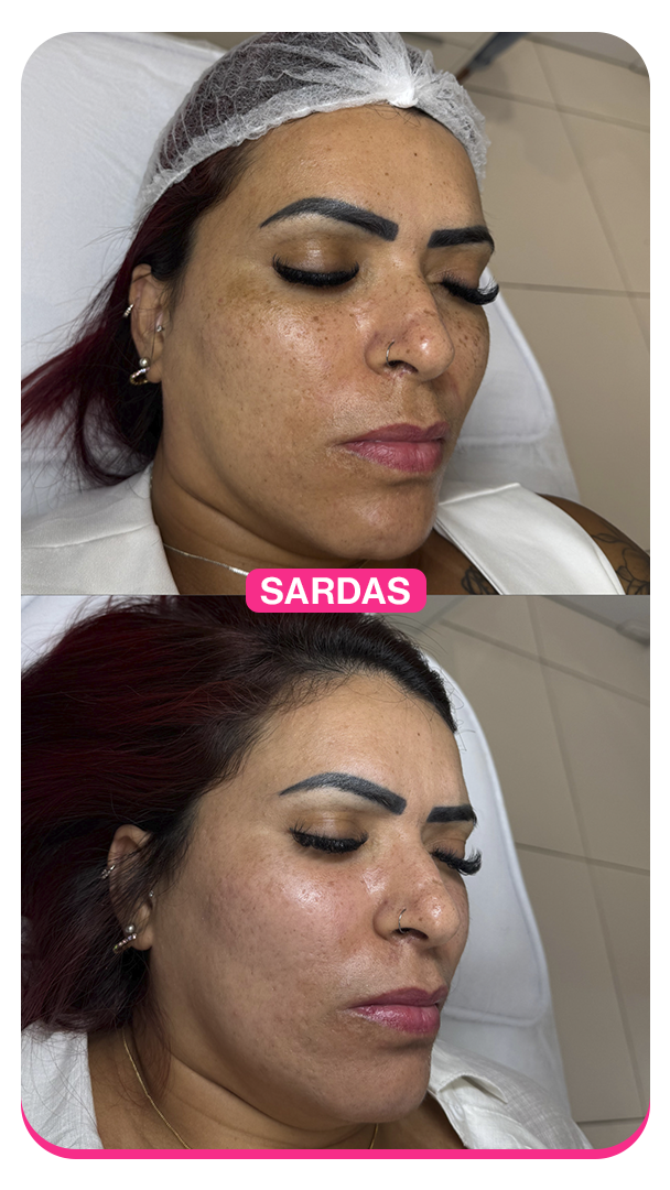Sardas